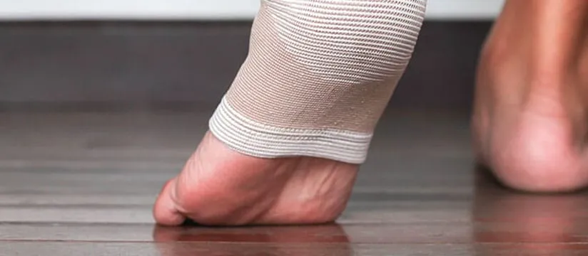 Foot with an ankle fracture