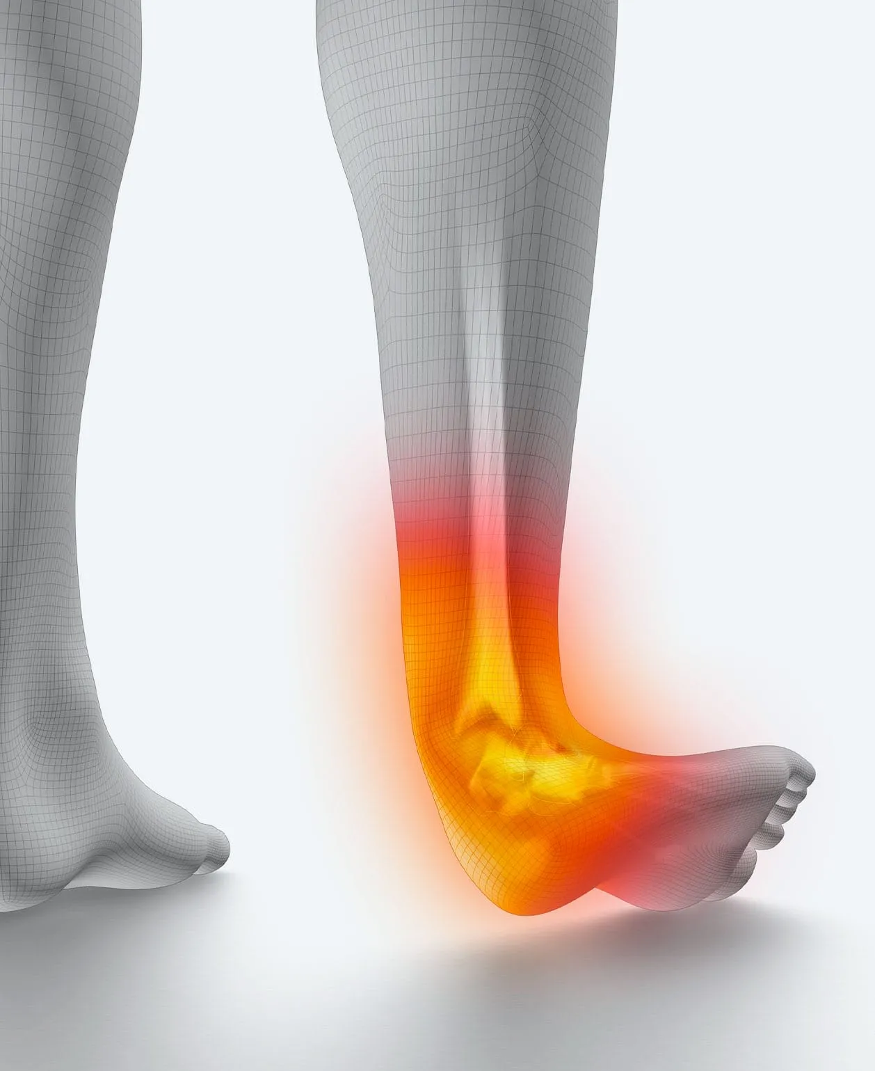 Ankle cartilage injury