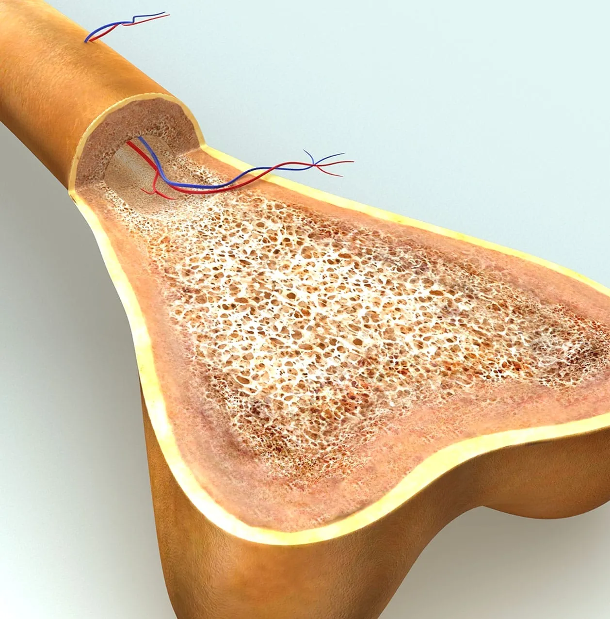 Bone marrow lesion in the ankle