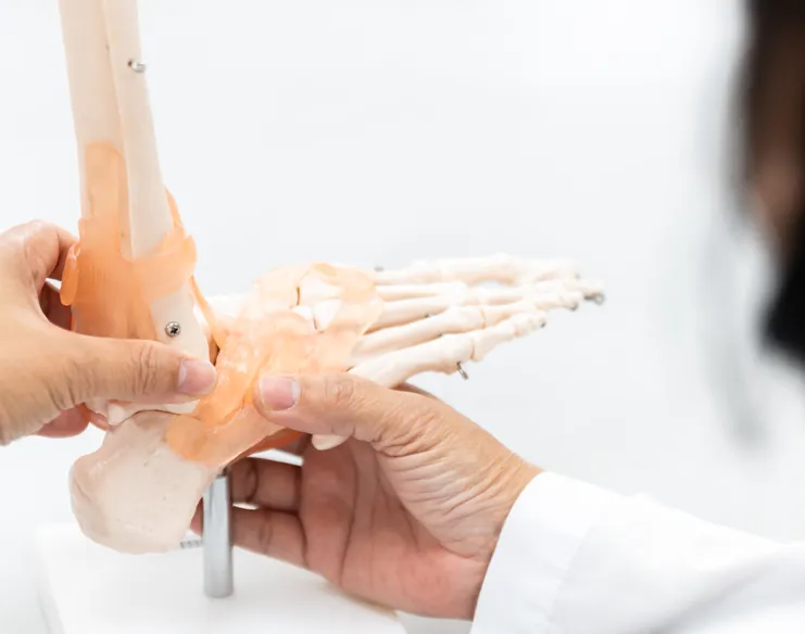 Ankle Fracture Surgery: What Happens and How Recovery Works